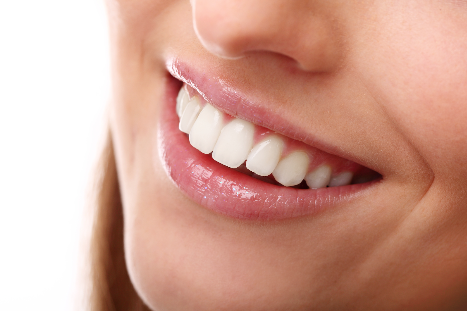 Most Common Questions About Teeth Whitening – Sacramento, CA