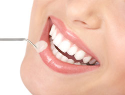 Dental Veneers: Reasons Why You Should Give It a Go!